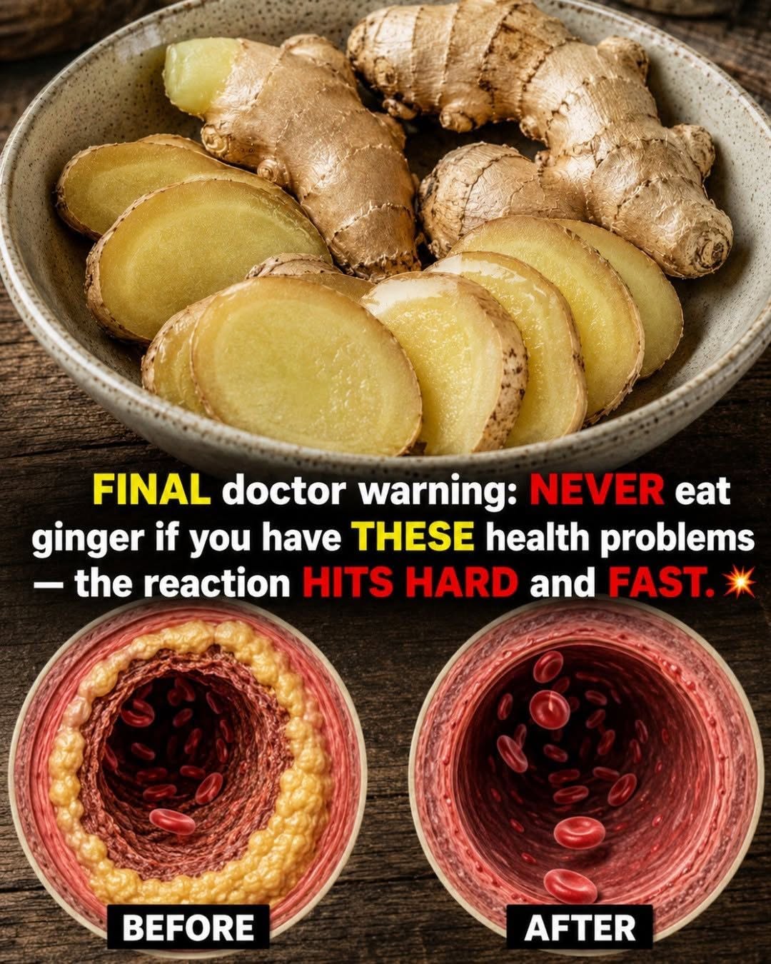 Never Eat Ginger If You Have These Health Problems — What You Should Know Before Using It