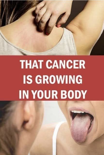 19 Warning Signs That Cancer May Be Developing in Your Body — What You Should Never Ignore