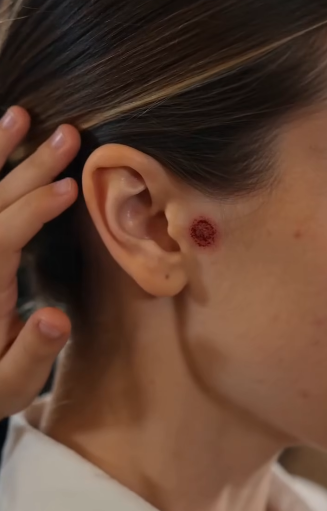 THE SON BRUSHED HER HAIR ASIDE… THEN THE SCAR EXPOSED THE FIANCÉ’S DARKEST DECEPTION