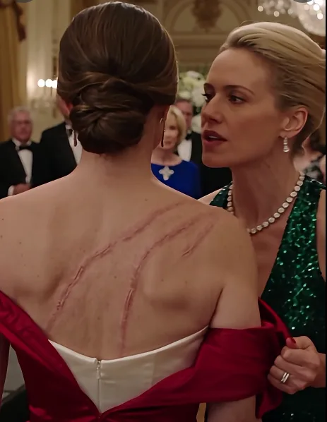My sister ripped open my blouse at Dad’s retirement gala to show 200 guests my scars—then a Navy Admiral saluted me, and Dad’s whiskey glass shattered.