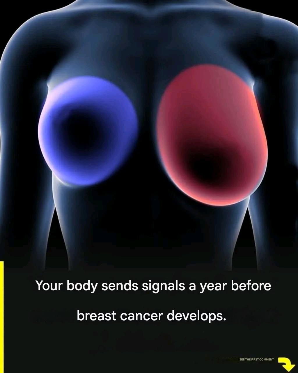 Breast Cancer Awareness: Four Early Warning Signs Every Woman Should Recognize