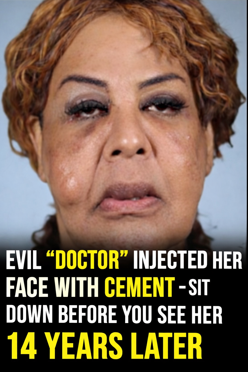 What “Cement Face” lady looks like 21 years later - Daily Stories