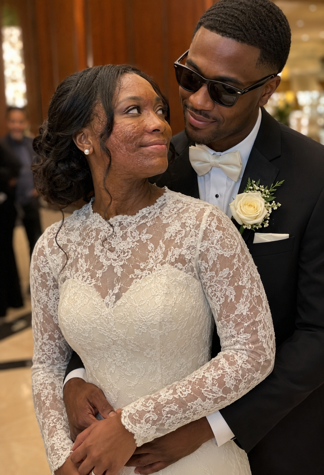 I Married a Blind Man So He'd Never See My Scars – On Our Wedding Night, He Said, 'You Need to Know the Truth I've Been Hiding for 20 Years'