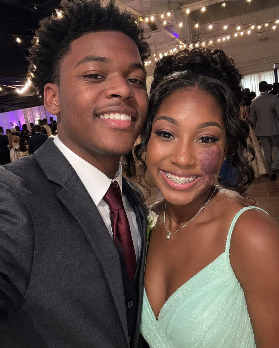 Only one boy asked me to prom since no one else wanted to go with me because of the birthmark on my face — everyone laughed until police officers walked into the gym.