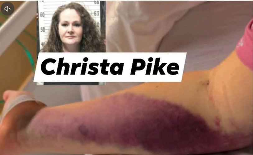 "🔥 CRIME SCENE EARTHQUAKE! — THE HARROWING INJURIES CHRISTA PIKE ENDURED BEHIND CLOSED DOORS!"