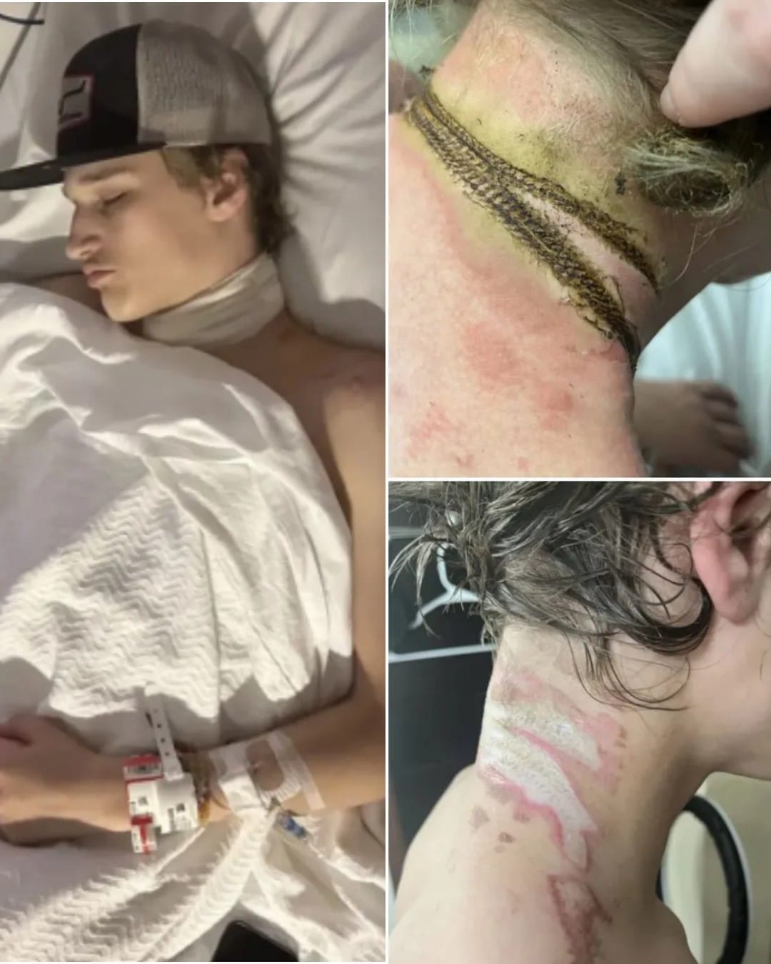 Shocking: Teen Nearly Killed by Necklace After Electrical Shock in Oklahoma Bedroom