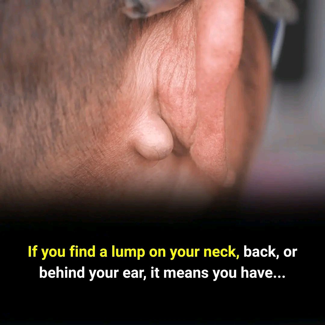 If You Find a Lump on Your Neck, Back, or Behind Your Ear — Here’s What It Could Mean