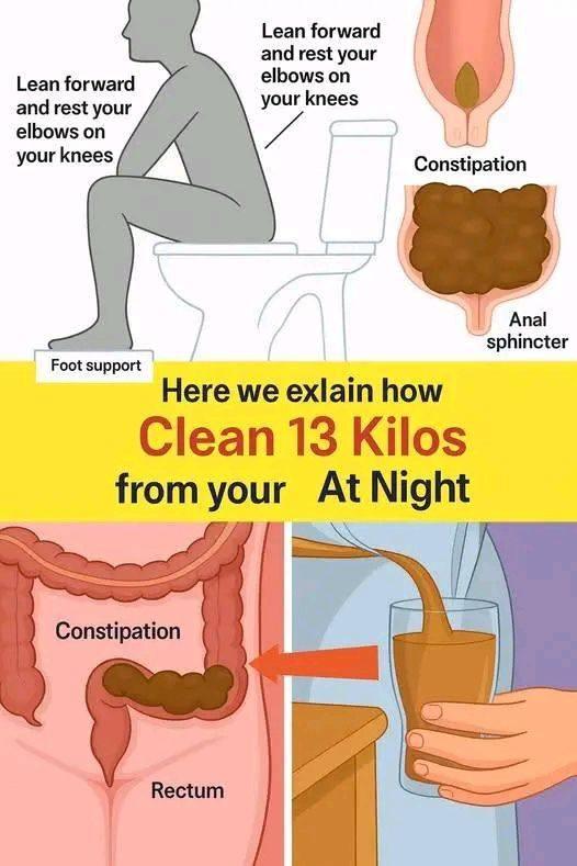Constipation Relief Posture, Habits, and Natural Care
