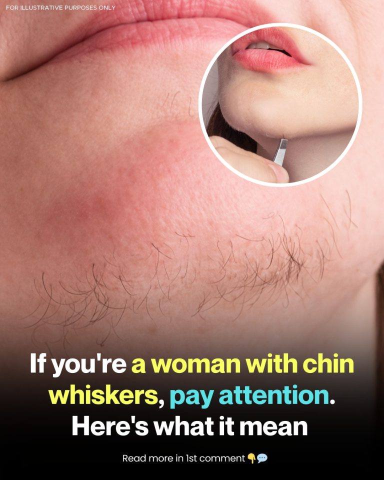 The Hidden Language of Chin Hair: Biology, Identity, and Health