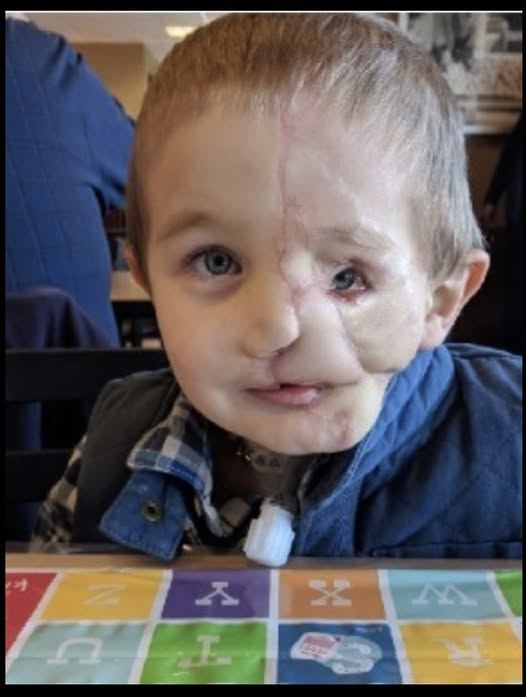 Ryder, 5, survives attack by two dogs – now cruel people call him a ”monster”