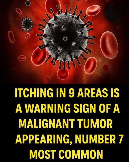 Itching in 9 Areas: Understanding Possible Health Signals