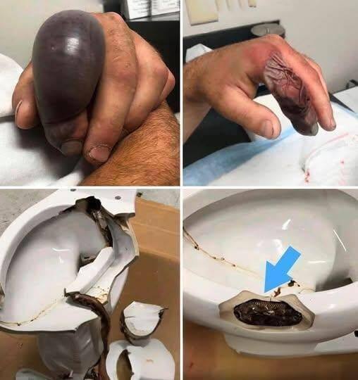 He went to the bathroom without knowing that there was a…