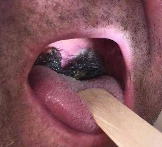 Here are the consequences of sleeping with