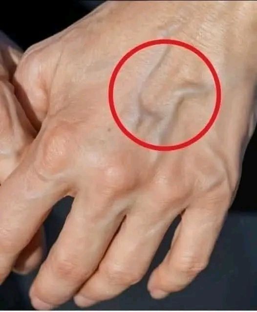 If You Have Visible Veins, It May Mean This… See More