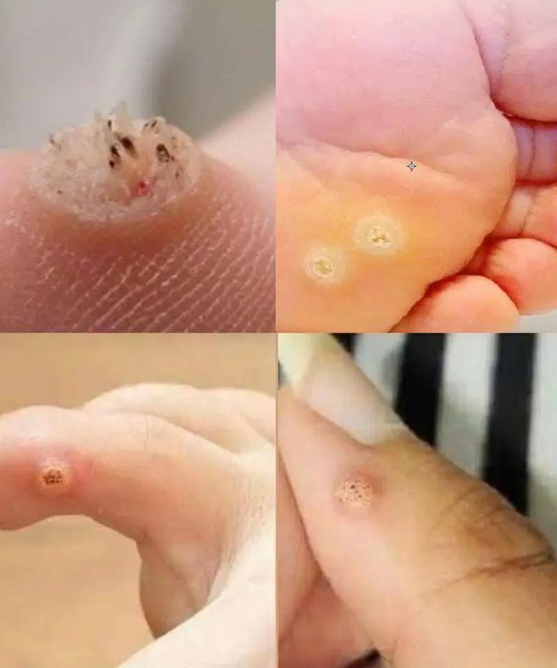 Important Warning: What It Means When This Appears in Your Mouth