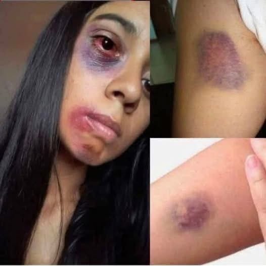 Young woman d..s at the hands of her…See more