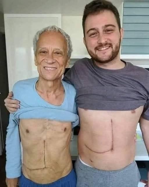 Son who donated part of his liver to his father, unfortunately, ends up fa… See more.