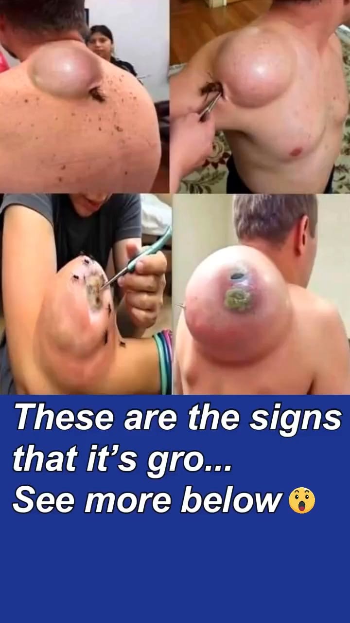 10 Warning Signs Your Body Sends When Something’s Wrong