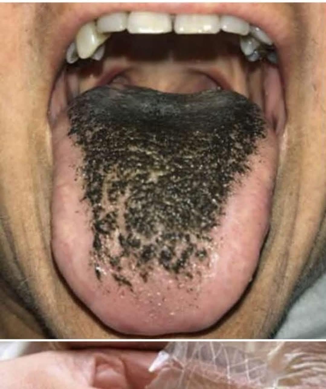 These are the consequences of sleeping with te