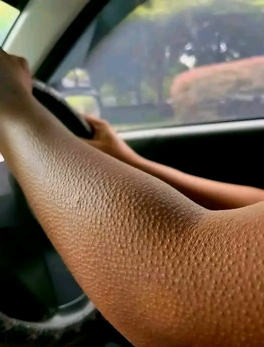 If Your Skin Looks Like This, Here’s What It Really Means