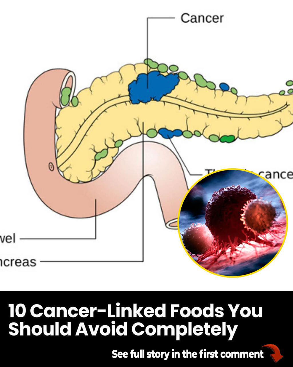 10 Cancer-Linked Foods You Should Never Put in Your Mouth Again