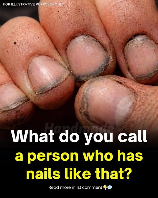 What Do Dirty Fingernails Really Say About a Person FIND OUT MORE IN THE COMMENTS