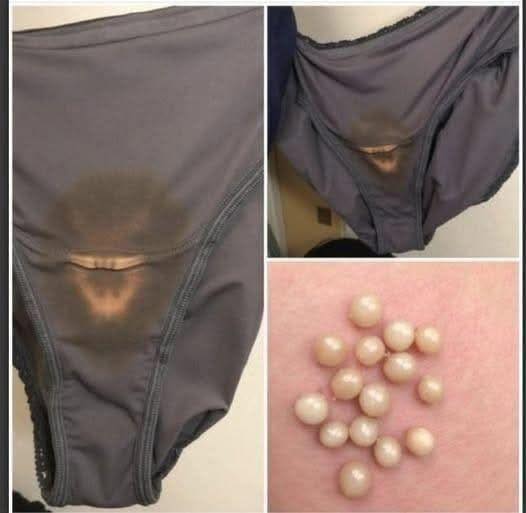 Some people are just finding out why they get bleach patches on their underwear