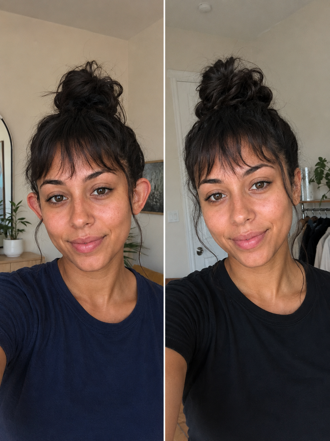 I Spent My Life Being Mocked for My Ears—After Surgery Changed My Face, My Mother Took One Look at Me and Burst Into Tears.