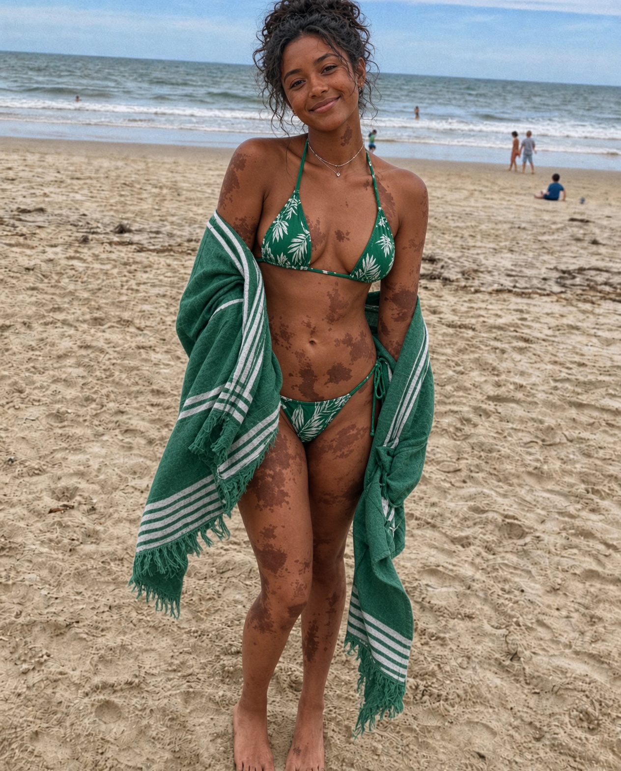 My Sister Said My Daughter’s Birthmarks Ruined Every Vacation Photo—Then My 10-Year-Old Son Said One Sentence That Made Her Run Out