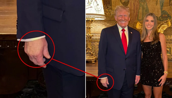 1  Trump’s Granddaughter Accidentally Reveals How Long He’s Had Hand Issues
