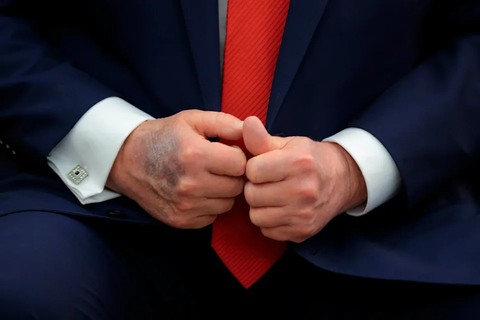 OMG Trump’s Quiet Moment in Washington: A Pause That Spoke Volumes hot