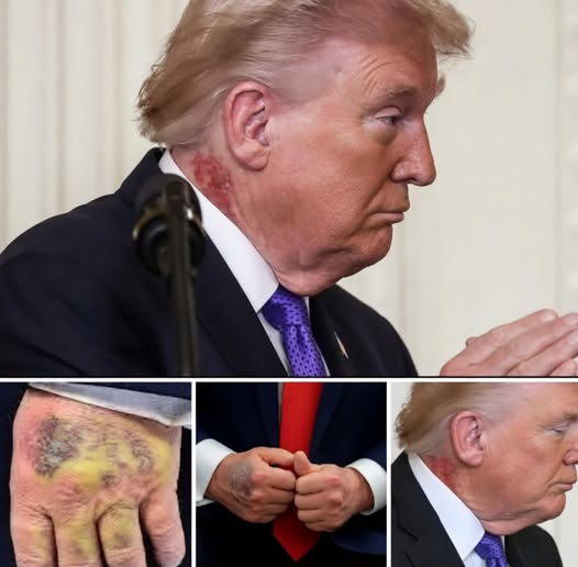 1 Trump’s Condition Has Escalated to... See more