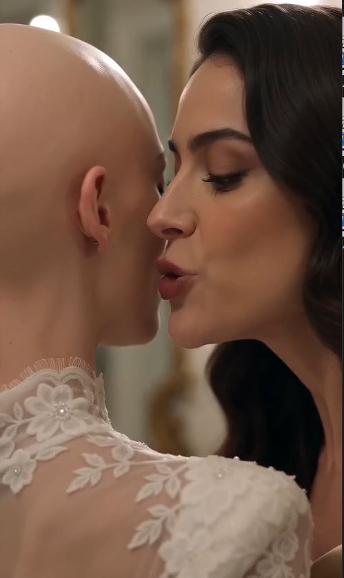 I Walked Into My $5 Million Wedding Bald After My Sister Hid My Wig—But My Billionaire Groom’s Announcement Made the Whole Room Stand 029
