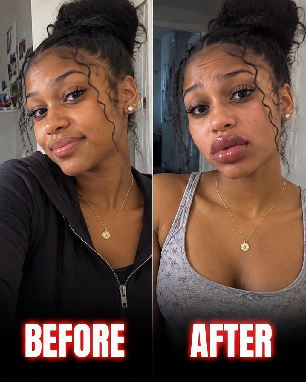 "Dad's new wife gave me the money." My 16-year-old got lip fillers behind my back — I called my ex ready to scream, and he only said: "Wait for me."