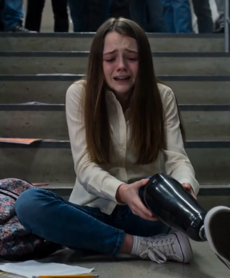 """ Girl With a Prosthetic Leg Was Pushed Down the Stairs—Then the Photos in Her Bag Exposed the Bully’s Secret
