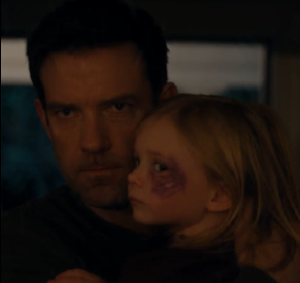 MY SISTER BRUISED MY LITTLE GIRL AND SAID