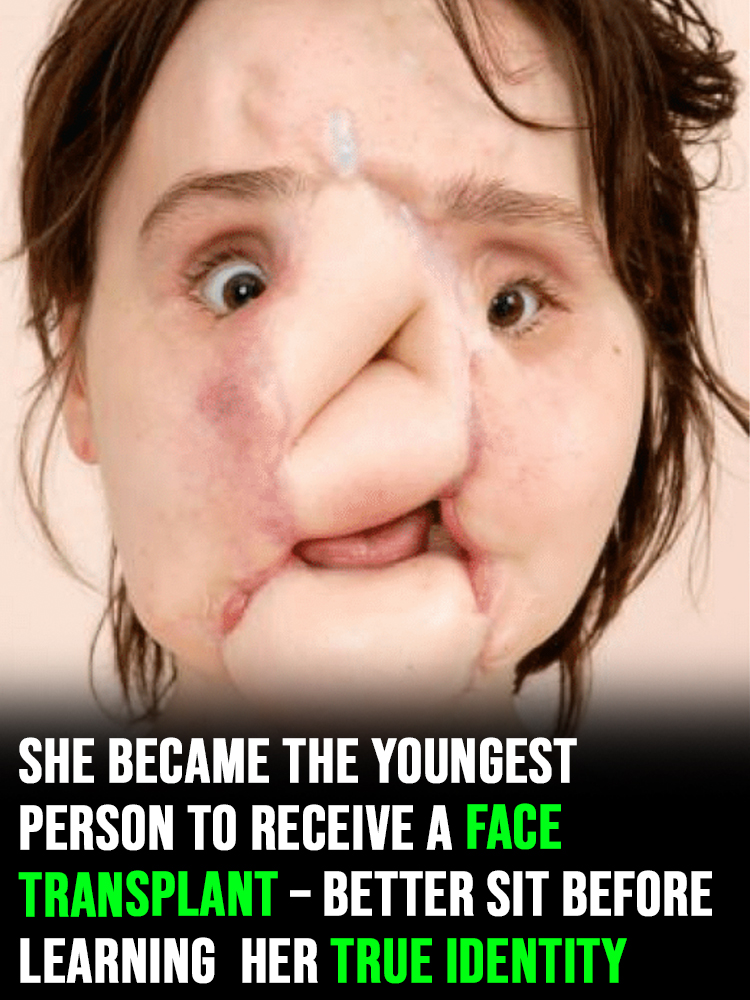 The amazing story of Katie Stubblefield: She became the youngest person to receive a face transplant