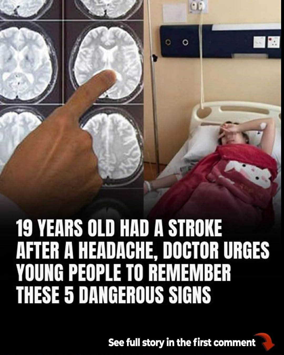 5 warning signs of stroke in young adults