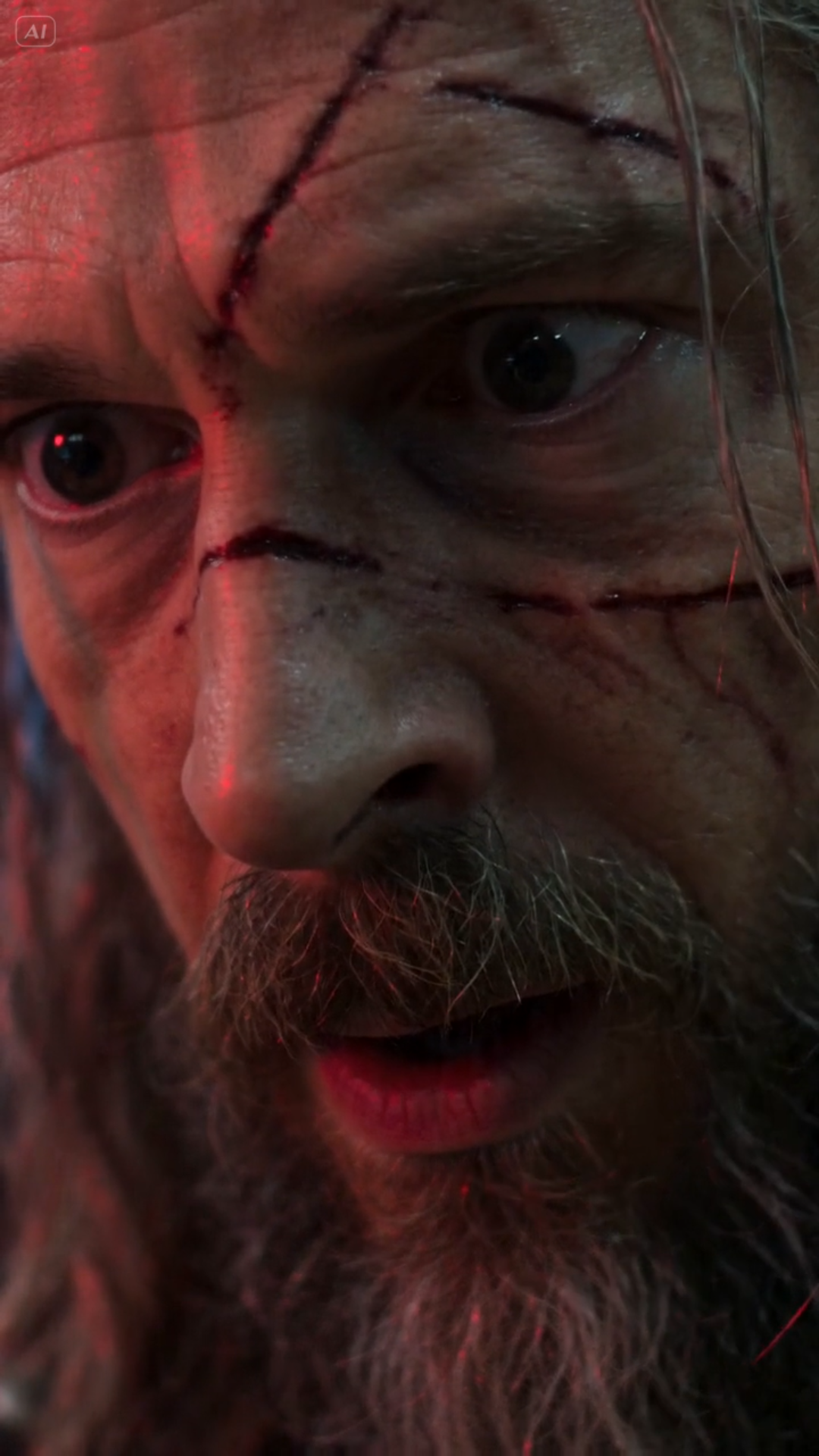 The Little Girl in the Purple Wheelchair Found the Man With the Scar
