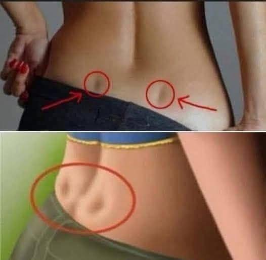 If You Have These Two “Dimples” on Your Lower Back, Here’s What They Mean