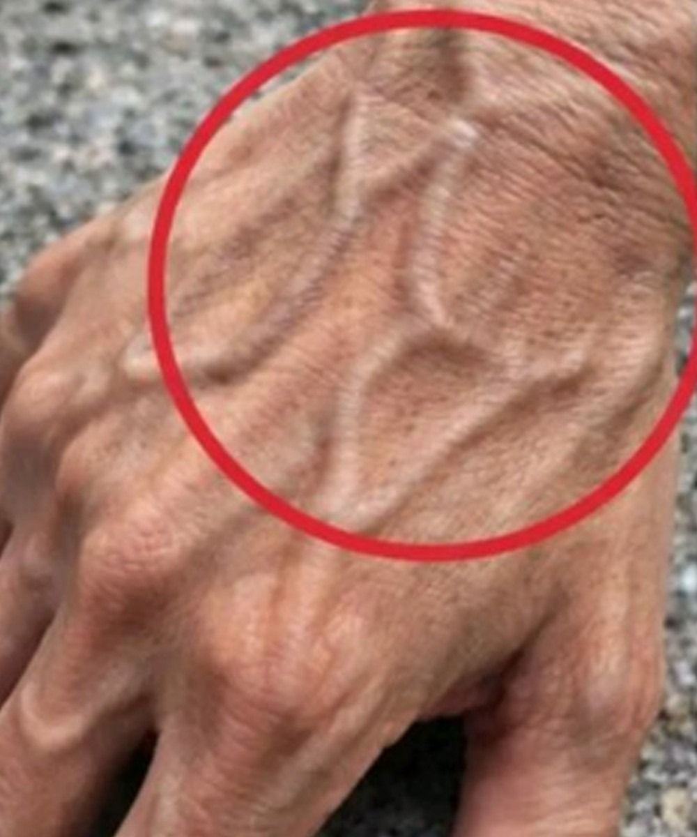 If Your Hand Veins Are Visible, Here’s What Your Body May Be Telling You
