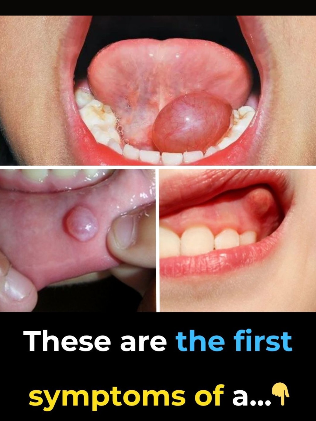 Hidden Dangers in Your Mouth: 10 Early Warning Signs of Oral Cancer You Should Never Ignore