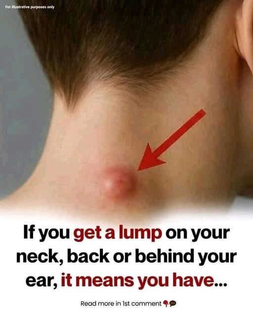 If you get a lump on your neck, back or behind your ear, it means that…