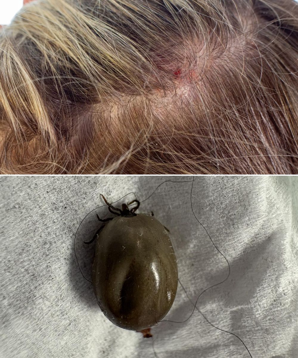 How to stay calm when you find unwanted “guests” in your child’s hair.