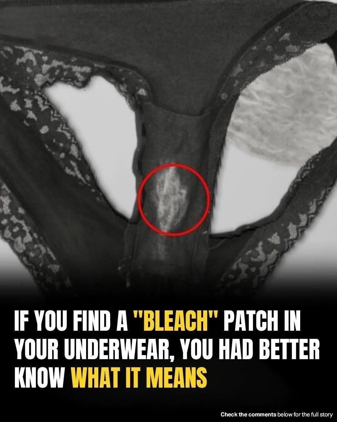 If you find a “bleach” patch on your underwear, here’s what it means - Page 2 of 2 - Daily Stories
