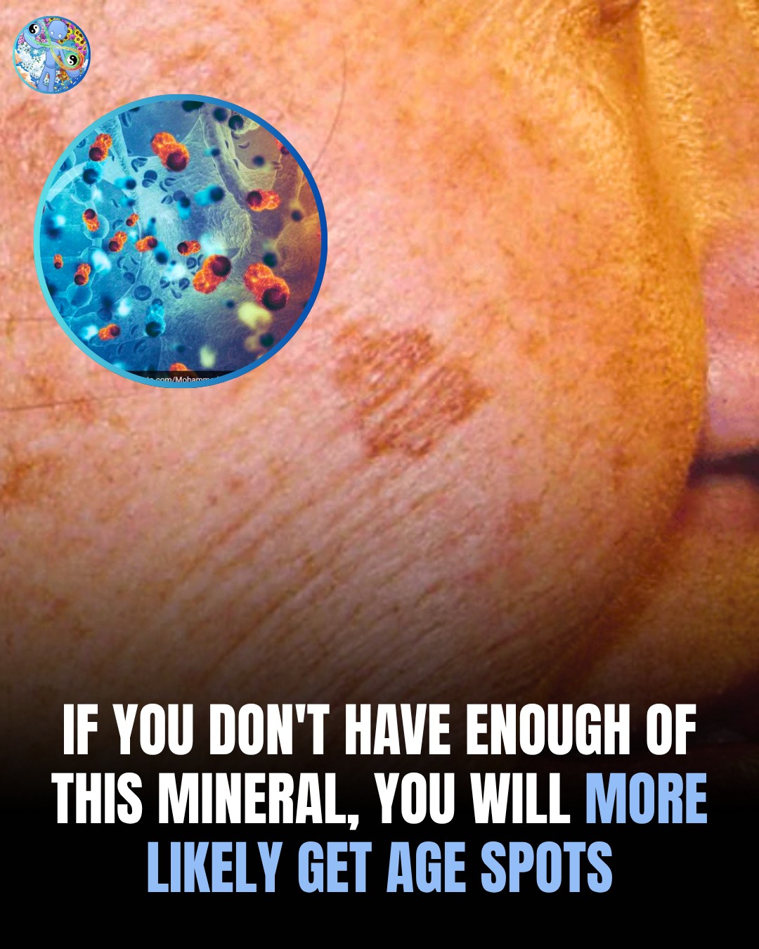 If You Don’t Have Enough of This Mineral, You Will More Likely Get Age Spots
