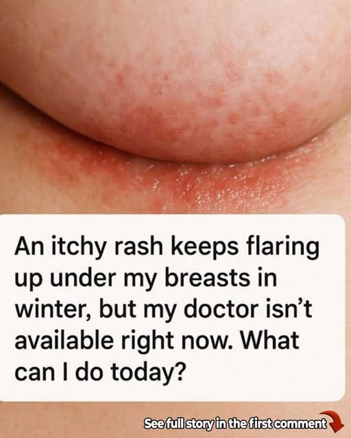 Painful Underboob Rash? 5 Common Causes You Should Know