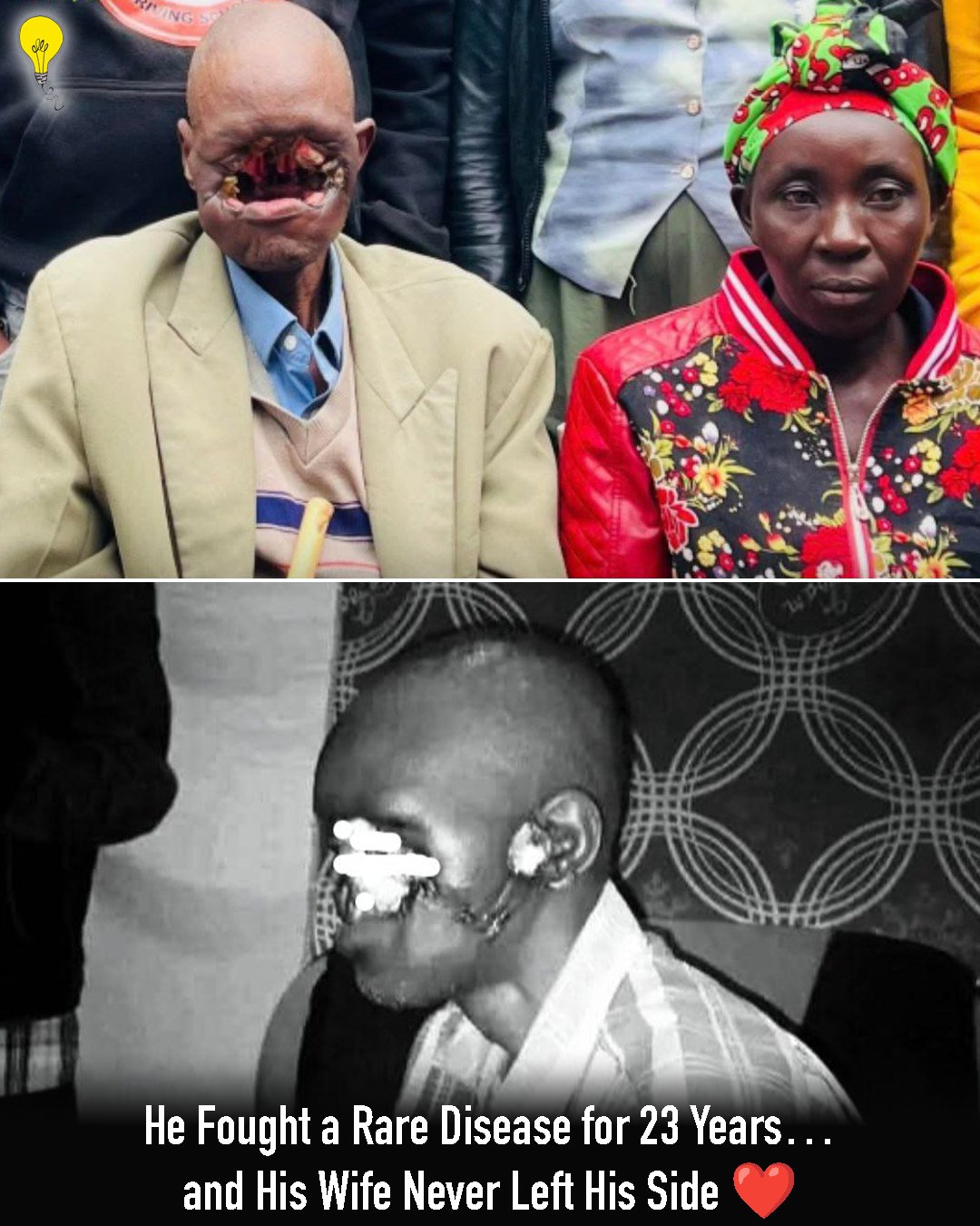 He fought a rare disease for 23 years...