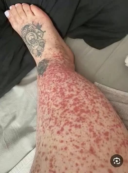 These are the consequences of sleeping with…See more below