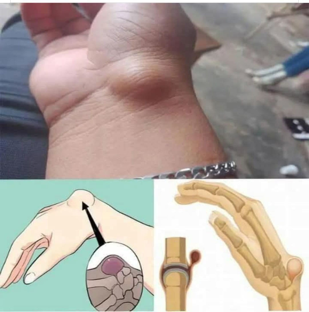 Unexplained Bruises? When to Be Concerned and What Could Be Causing Them
